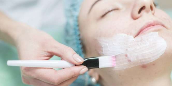 Biar Jerawat Tak Kambuh Lagi, Jangan Lupa Fase Ini
