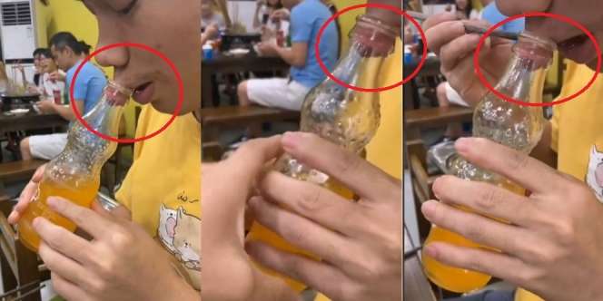 Kelewat Iseng Saat Gabut, Bibir Pria Ini Masuk ke Botol dan Ga Bisa Dilepas