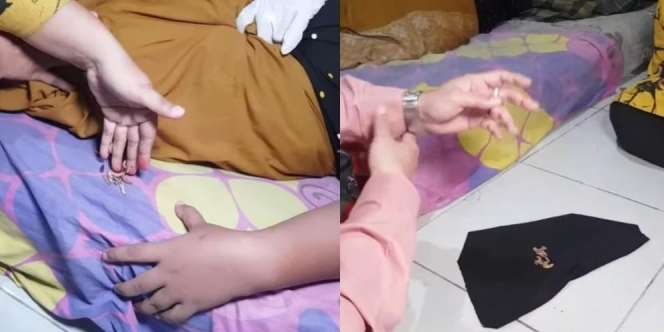 Kalah Perang Santet dari Istri Sah, Pelakor Keluar Belatung Tiap Buang Air Kecil