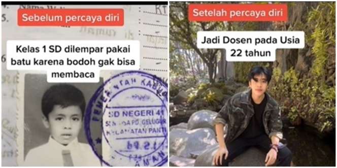 Kelas 1 SD Diejek Tak Bisa Baca, Kini Jadi Dosen di Usia Muda