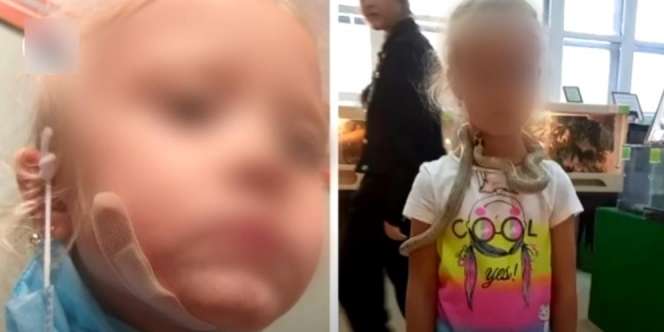 Bocah Ini Alami Nasib Tragis Usai Berpose dengan Ular di Kebun Binatang
