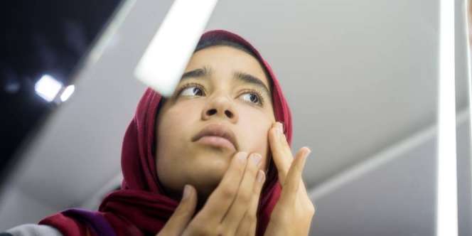Jerawat Hormonal Bisa Muncul Kapan Saja, Kenali Tanda Khasnya