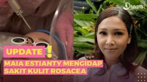Maia Estianty Mengidap Penyakit yang Sulit Disembuhkan