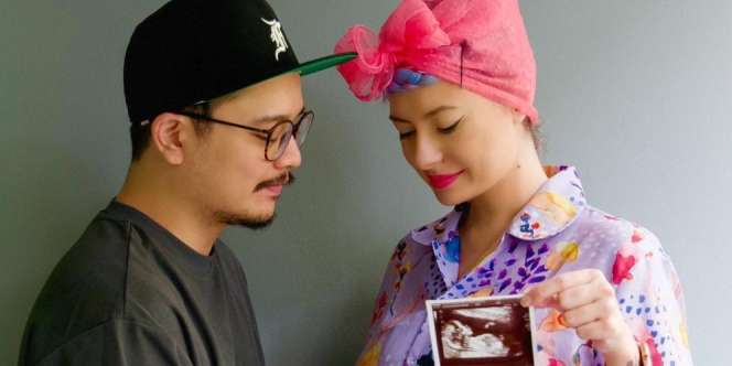 Istri Derby Romero Hamil Anak Pertama Setelah Penantian 4 Tahun