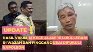 Wajah Lebam YouTuber M Kece Dihajar Sesama Tahanan