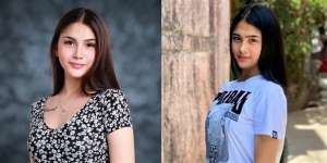 Cantik Bak Bidadari, Foto Masa Lalu Selebgram Ini Bikin Syok!