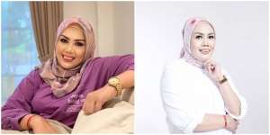 Potret Elly Sugigi Sebelum-Sesudah Perawatan, Melongo Lihatnya