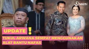 Tukul Arwana Sempat Menggunakan Alat Bantu Nafas