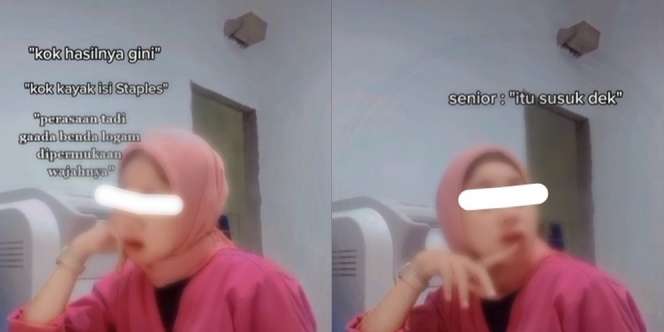 Penampakan Wajah Pasien Penuh Susuk Saat Rontgen, Mirip Isi Staples Bertebaran