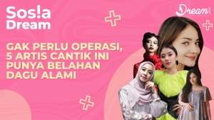 Gak Perlu Operasi! 5 Artis Cantik Ini Punya Belahan Dagu Alami