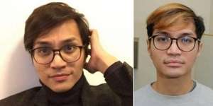Beredar Foto Predator Seksual Sesama Jenis Reynhard Sinaga Bonyok, Korban Buka Suara