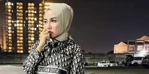 Bikin Heboh, Medina Zein Unggah Foto Wajah Lebam dan Sebut Suami Pengecut