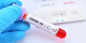 Update Covid-19 12 Oktober 2021: Kasus Harian Capai 1.261