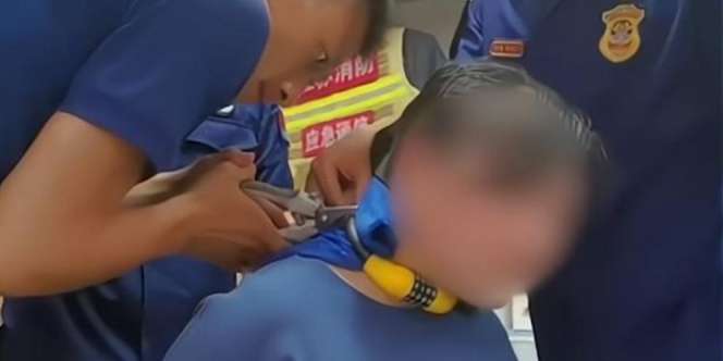 Ibu Anggap Lucu Balita Kalungi Gembok Sepeda di Lehernya, Panik Saat Tahu Nomor Kombinasi Berubah
