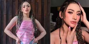 Dulu Terseret Kasus Prostitusi, Intip 8 Foto Terbaru Amel Alvi yang Makin Berani