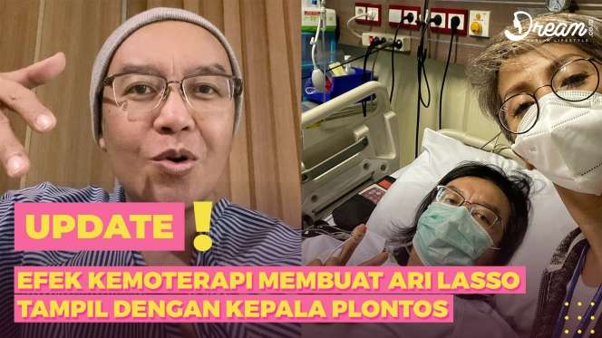 Efek Kemoterapi, Ari Lasso Tampil Plontos