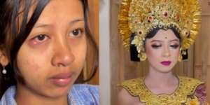 Pengantin Alami Sakit Mata, Hasil Riasan MUA Bikin Melongo
