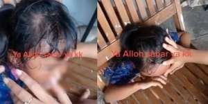 Mau Ketawa tapi Kasihan, Kepala Bocah Ini Kejepit Kursi dan Tak Bisa Keluar