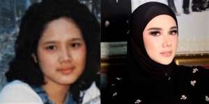 10 Potret Artis Sebelum VS Sesudah Mengenal Perawatan, Cita Citata Beda Banget!