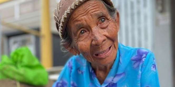 Hasil Jualan Bedak Dicuri, Nenek Ini Tak Bisa Jalani Operasi Katarak