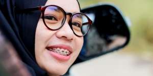 Hukum Memakai Behel dalam Islam, Begini Pendapat yang Mengharamkan dan Memperbolehkan