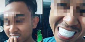 Termakan Iklan di TikTok, Gigi Putih Sempurna Suami Malah Bikin Istri Ngakak Guling-Guling