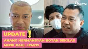Anang Hermansyah Botak, Jadi Mirip Raul Lemos 