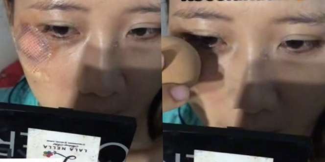 MUA Tak Tega Merias Pengantin yang Kecelakaan H-1 Resepsi, Prosesnya Bikin Ngilu