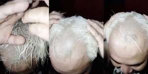 Lakukan Bleaching Rambut Sendiri di Rumah Malah Berakhir Zonk, Auto Jadi 'Albert Einstein'
