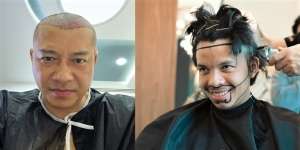 6 Potret Artis Sebelum Vs Sesudah Transplantasi Rambut, Atta Halilintar Makin Keren & Ganteng Abis!
