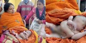 Bayi di India Lahir dengan 4 Tangan dan 4 Kaki, Warga Percaya Sebagai Titisan Dewa