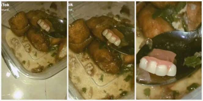Mau Ngakak Tapi Jijik, Beli Cuanki Dapat Tambahan Gigi Palsu: Bonusnya Lebih Mahal dari Makanannya