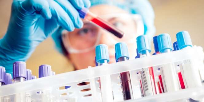 Muncul Varian Baru di Tengah Penyebaran Omicron, 'Son of Omicron' Pembuat Ilmuwan Khawatir