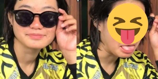Ngakak! TikTokers Kece Berkacamata Hitam, Pas Dibuka Banyak yang Kecele