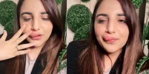 Suntik Filler di Luar Negeri, Seleb TikTok Malu dengan Nasib Bibir yang Terkatung-katung Gegara Tak Bisa Bayar