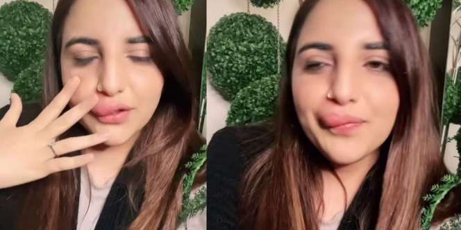 Suntik Filler di Luar Negeri, Seleb TikTok Malu dengan Nasib Bibir yang Terkatung-katung Gegara Tak Bisa Bayar