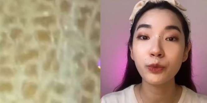 Kulit Bertekstur Seperti Sisik Ikan, Ini Penyebabnya