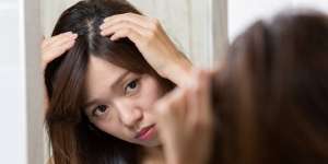 3 Kebiasaan Merawat Rambut yang Picu Munculnya Ketombe