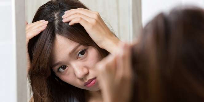 3 Kebiasaan Merawat Rambut yang Picu Munculnya Ketombe