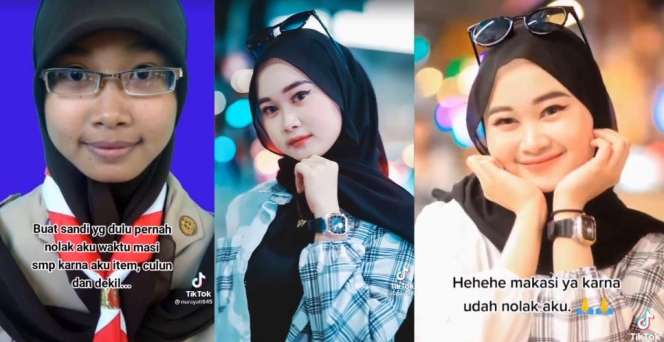 Waktu SMP Ditolak Karena Dibilang Dekil dan Hitam, Kini Cowoknya Menyesal Setengah Mati