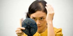 Efektifkah Prosedur Tanam Rambut dalam Mengatasi Kebotakan?