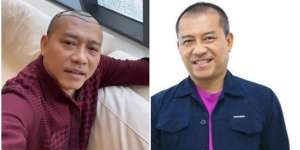 8 Potret Sebelum dan Sesudah Anang Hermansyah Lakukan Transplantasi Rambut, Terlihat Lebih Muda!