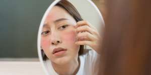 Tidak Dapat Disembuhkan, Dermatitis Atopik Bisa Dikendalikan Dengan 3 Cara Ini