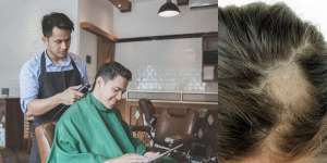 Hati-Hati! Alat Cukur Tidak Steril Bisa Sebabkan Masalah Rambut Serius