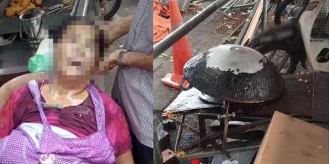 Penjual Pisang Goreng Meninggal Mengenaskan, Tiba-Tiba Pingsan dan Kepalanya Masuk Wajah Berisi Minyak Panas