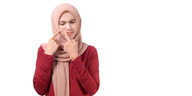 Atasi Kemerahan karena jerawat dengan Bahan Alami Ini!