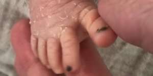 Tak Bisa Bedakan Bayi Kembarnya, Ibu Beri Cat di Jari Kaki 