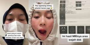 Mata Kedutan 3 Hari Berturut-turut dan Mulut Meleyot, Setelah Diperiksa Wanita Ini Auto Syok
