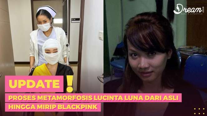 Proses Metamorfosis Lucinta Luna dari Asli hingga Mirip Blackpink