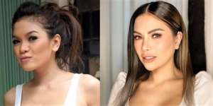 9 Potret Artis Sebelum VS Sesudah Oplas Hidung, Seleb Terakhir Disebut Aneh & Banjir Hujatan!